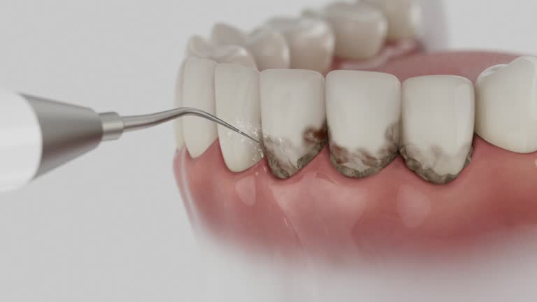 Trusted Dental Implants service in Easton, CA - Dentist Open Now